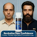 Hair & Beard Growth Kit with Minoxidil & Derma Roller